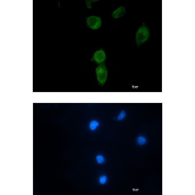 1 - CLPX Rabbit mAb AP76444