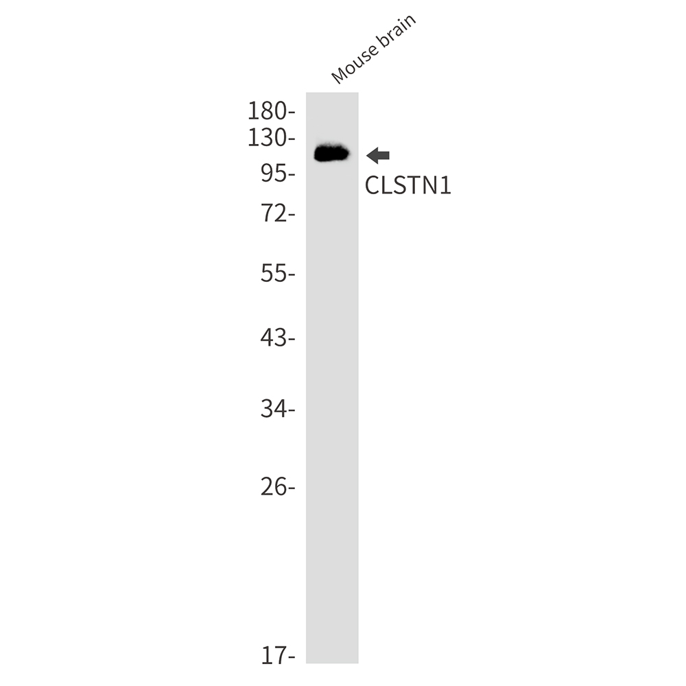2 - CLSTN1 Rabbit mAb AP76445