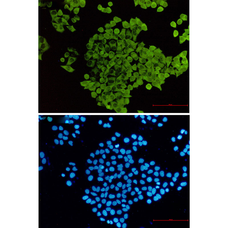3 - [KO]Cofilin 1 Rabbit mAb AP76446
