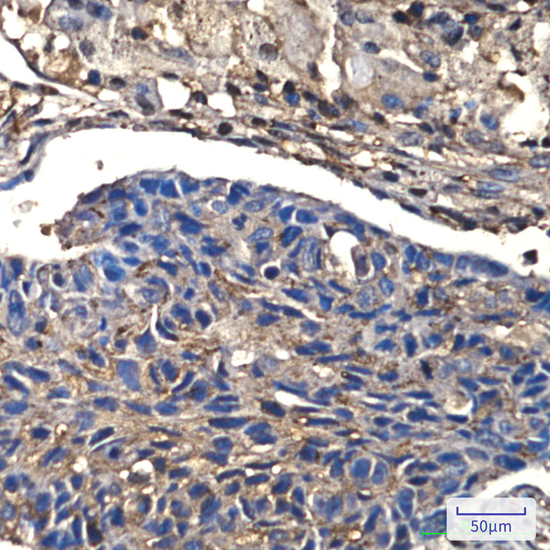 0 - [KO]Cofilin 1 Rabbit mAb AP76446