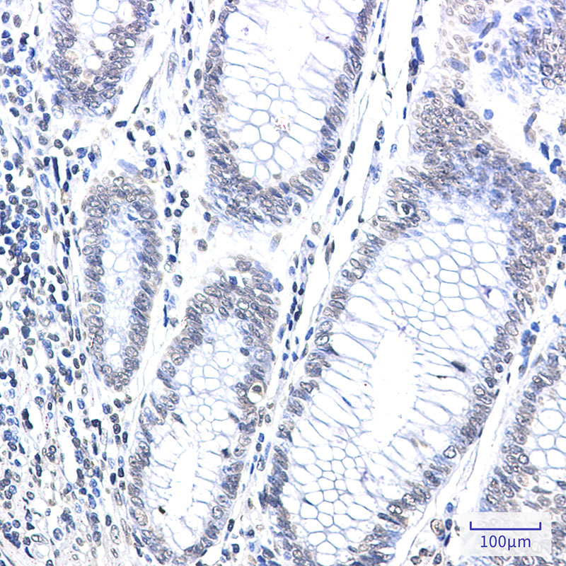 2 - CPS1 Rabbit mAb AP76447