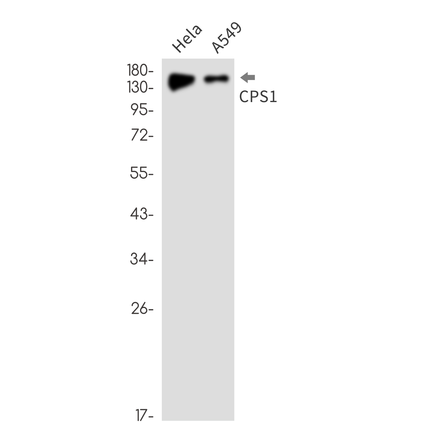 1 - CPS1 Rabbit mAb AP76447