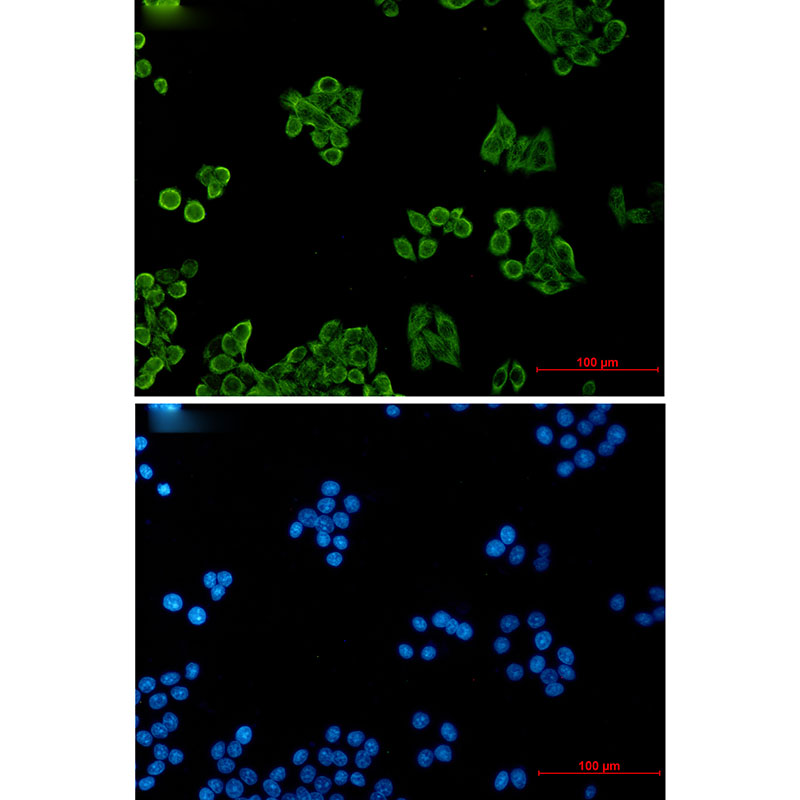 1 - CSDE1/NRU Rabbit mAb AP76450