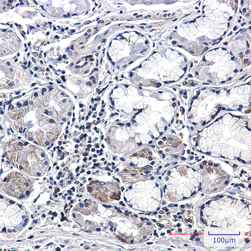 8 - CSDE1/NRU Rabbit mAb AP76450