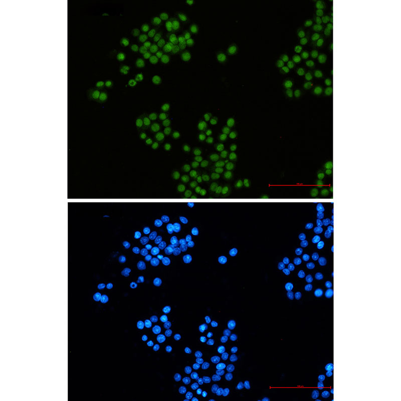 4 - CTBP2 Rabbit mAb AP76454