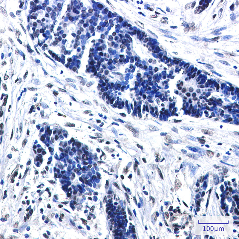 8 - CTBP2 Rabbit mAb AP76454