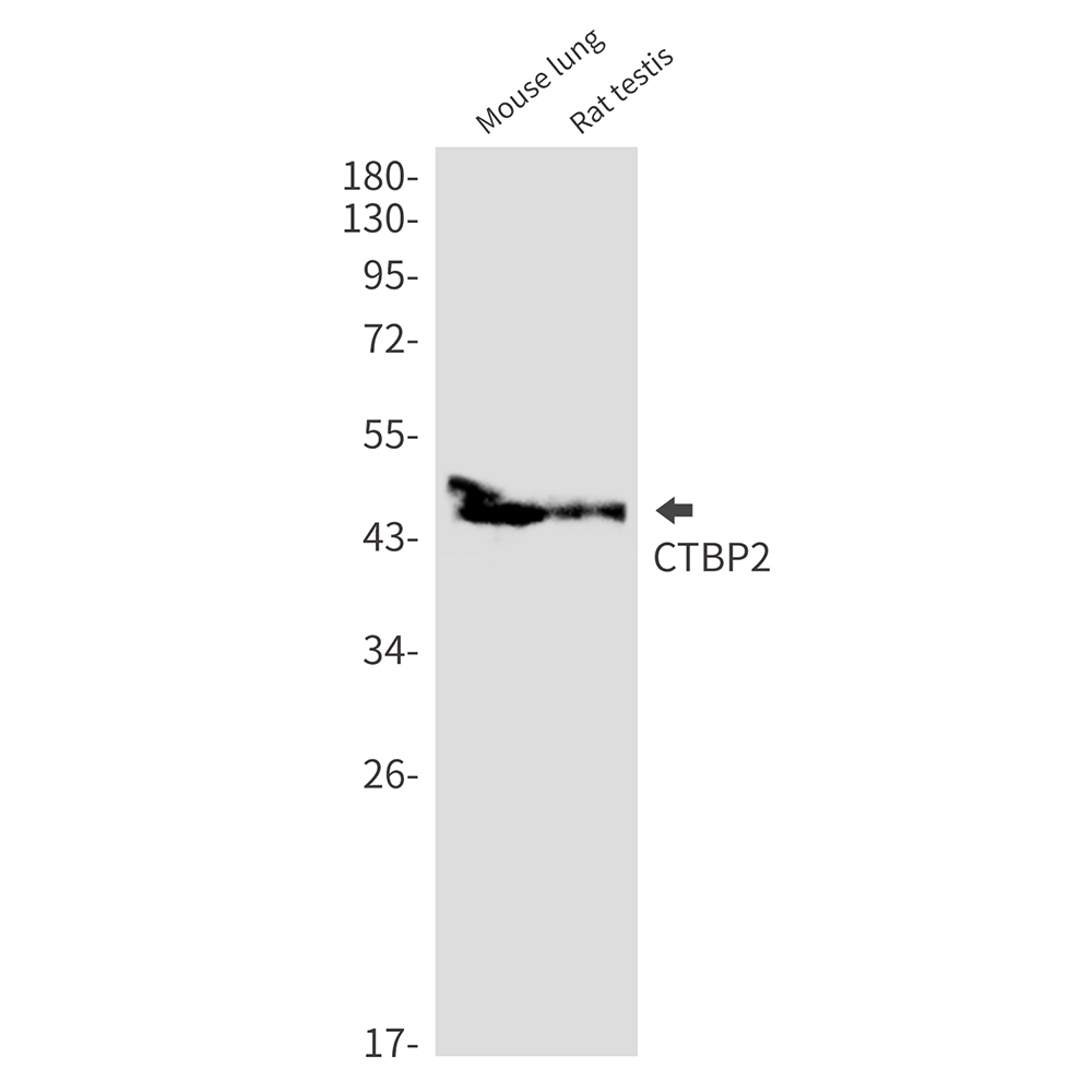 1 - CTBP2 Rabbit mAb AP76454