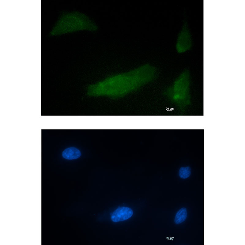 1 - CUG BP1 Rabbit mAb AP76455