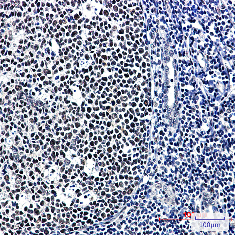 0 - CUG BP1 Rabbit mAb AP76455