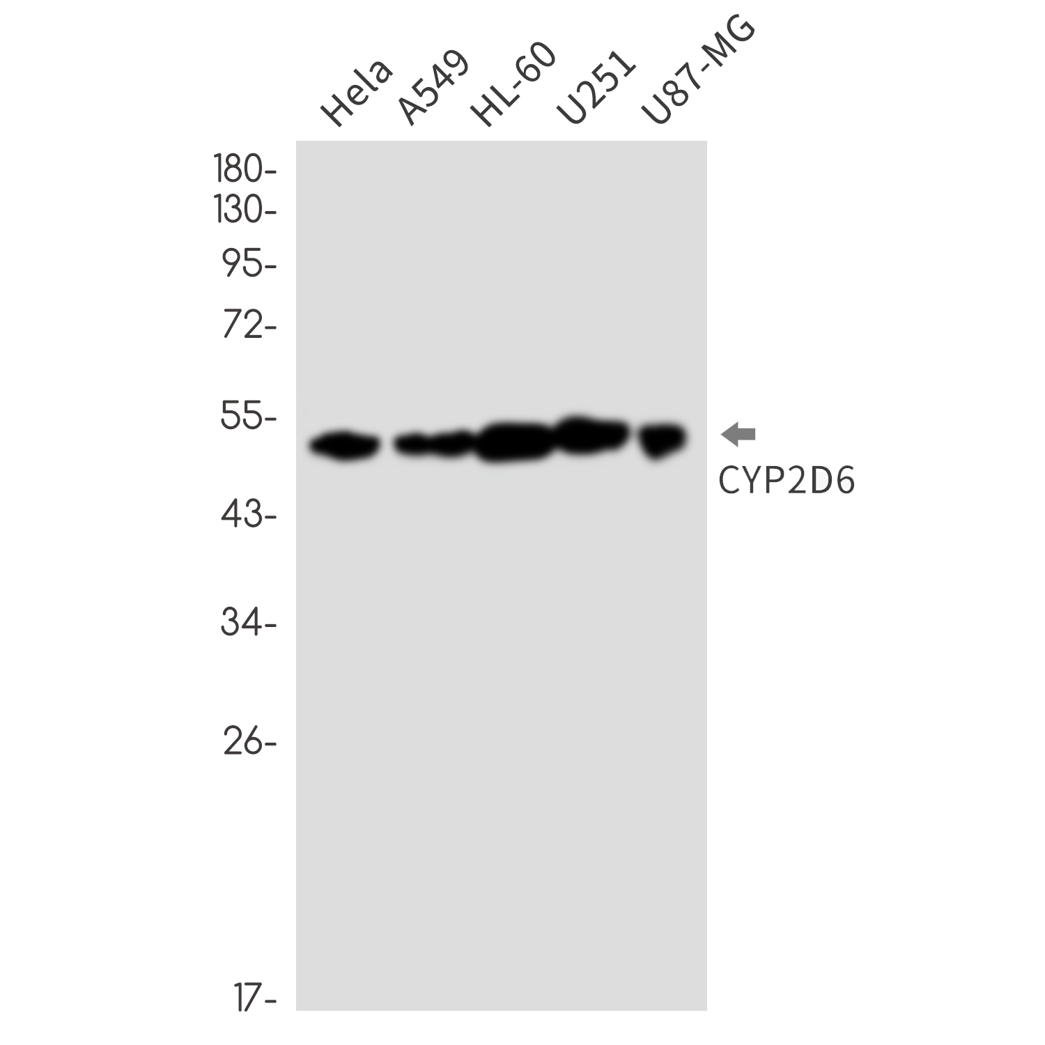 1 - Cytochrome P450 2D6 Rabbit mAb AP76459