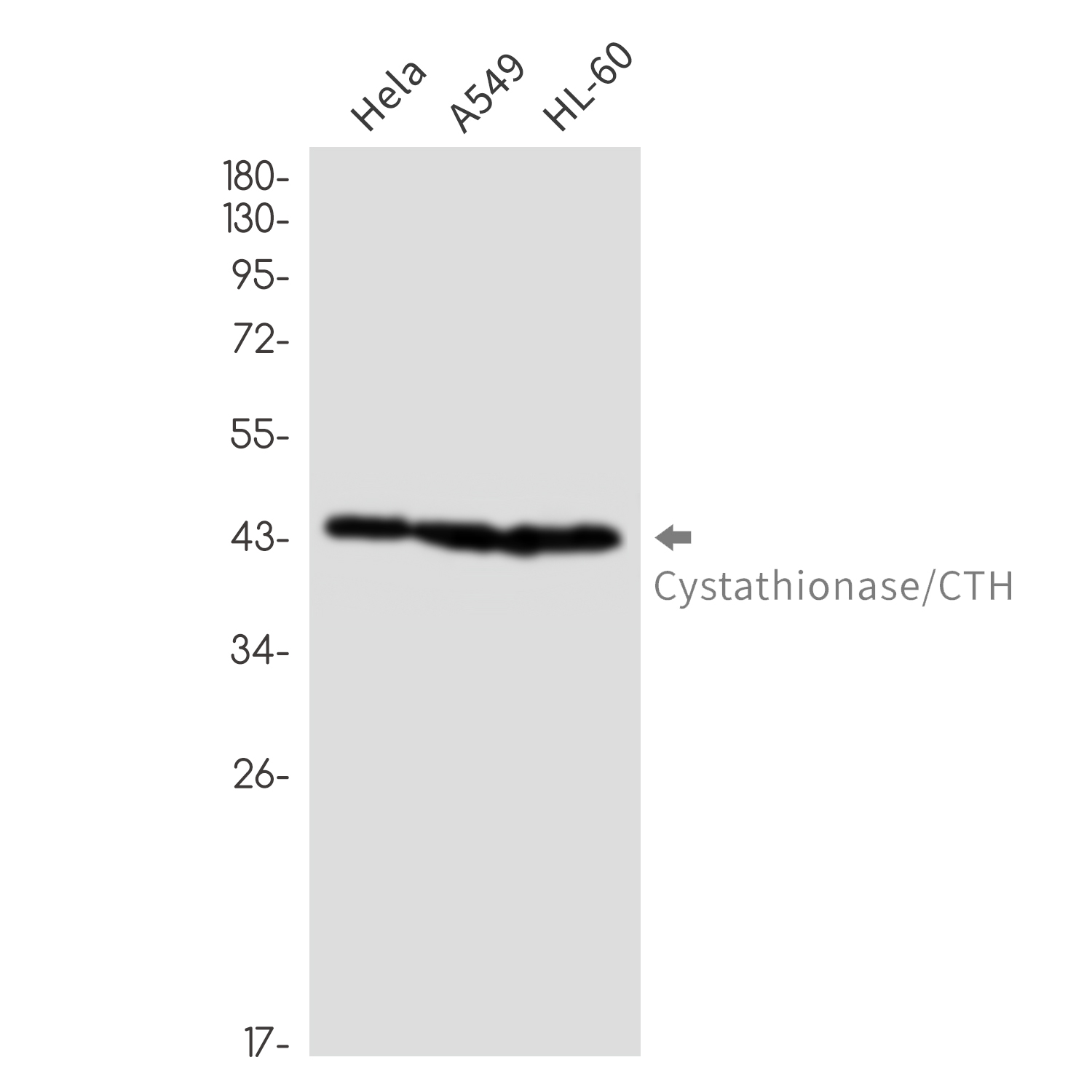 5 - [KO]Cystathionase Rabbit mAb AP76460