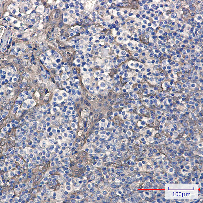 0 - Cystatin B Rabbit mAb AP76461