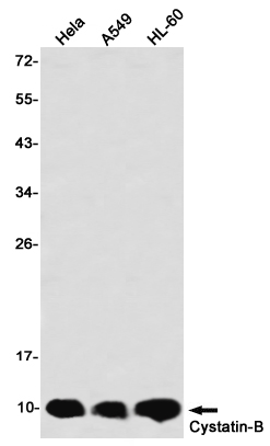 2 - Cystatin B Rabbit mAb AP76461