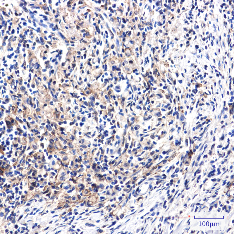 2 - [KO]DAB2 Rabbit mAb AP76463