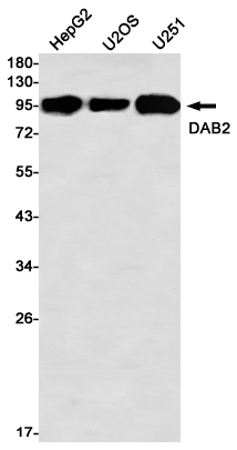 1 - [KO]DAB2 Rabbit mAb AP76463