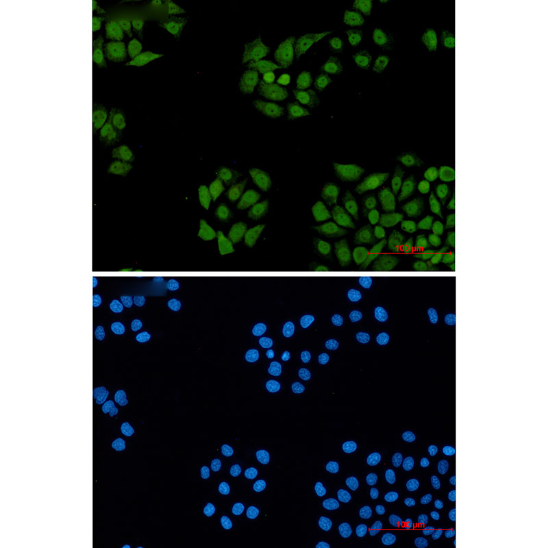 1 - DDB1 Rabbit mAb AP76465