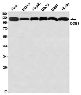 8 - DDB1 Rabbit mAb AP76465