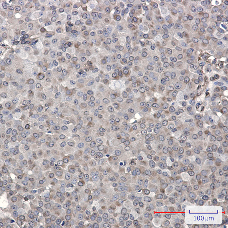 2 - DENN Rabbit mAb AP76466
