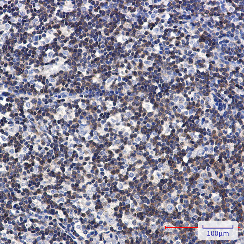 2 - [KD]DGKA Rabbit mAb AP76467
