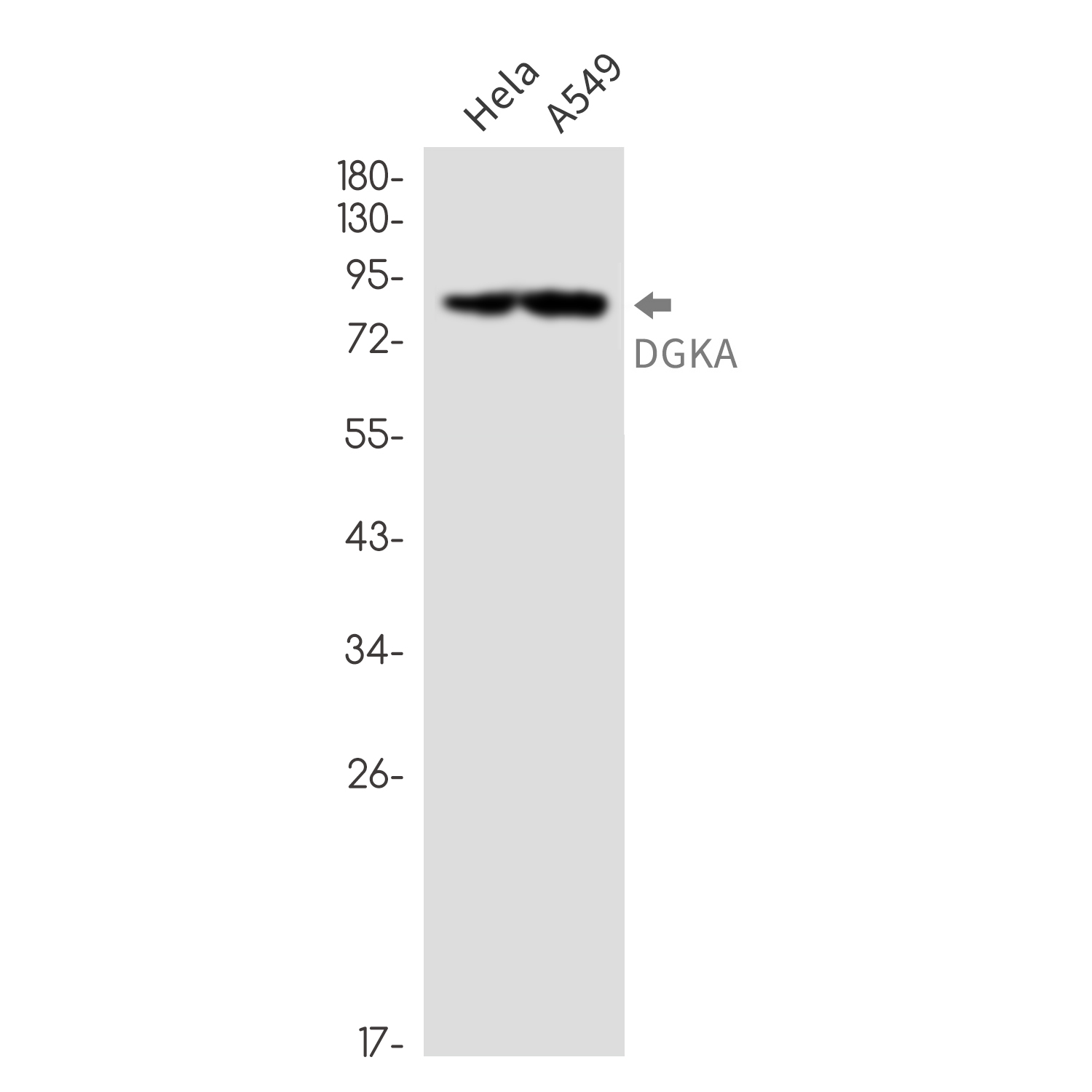 1 - [KD]DGKA Rabbit mAb AP76467