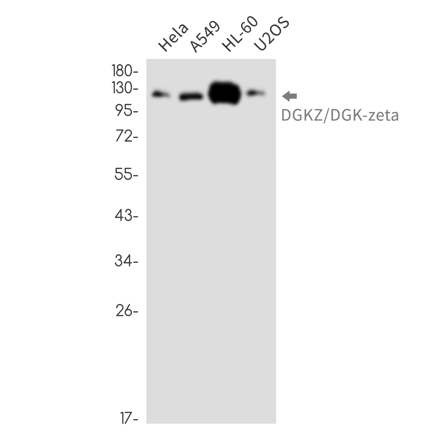 1 - DGKZ/DGK-zeta Rabbit mAb AP76468