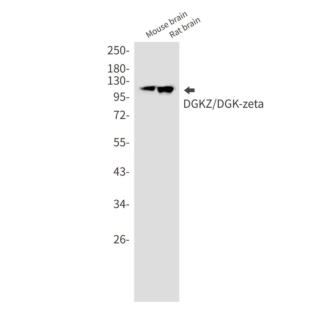 1 - DGKZ/DGK-zeta Rabbit mAb AP76469