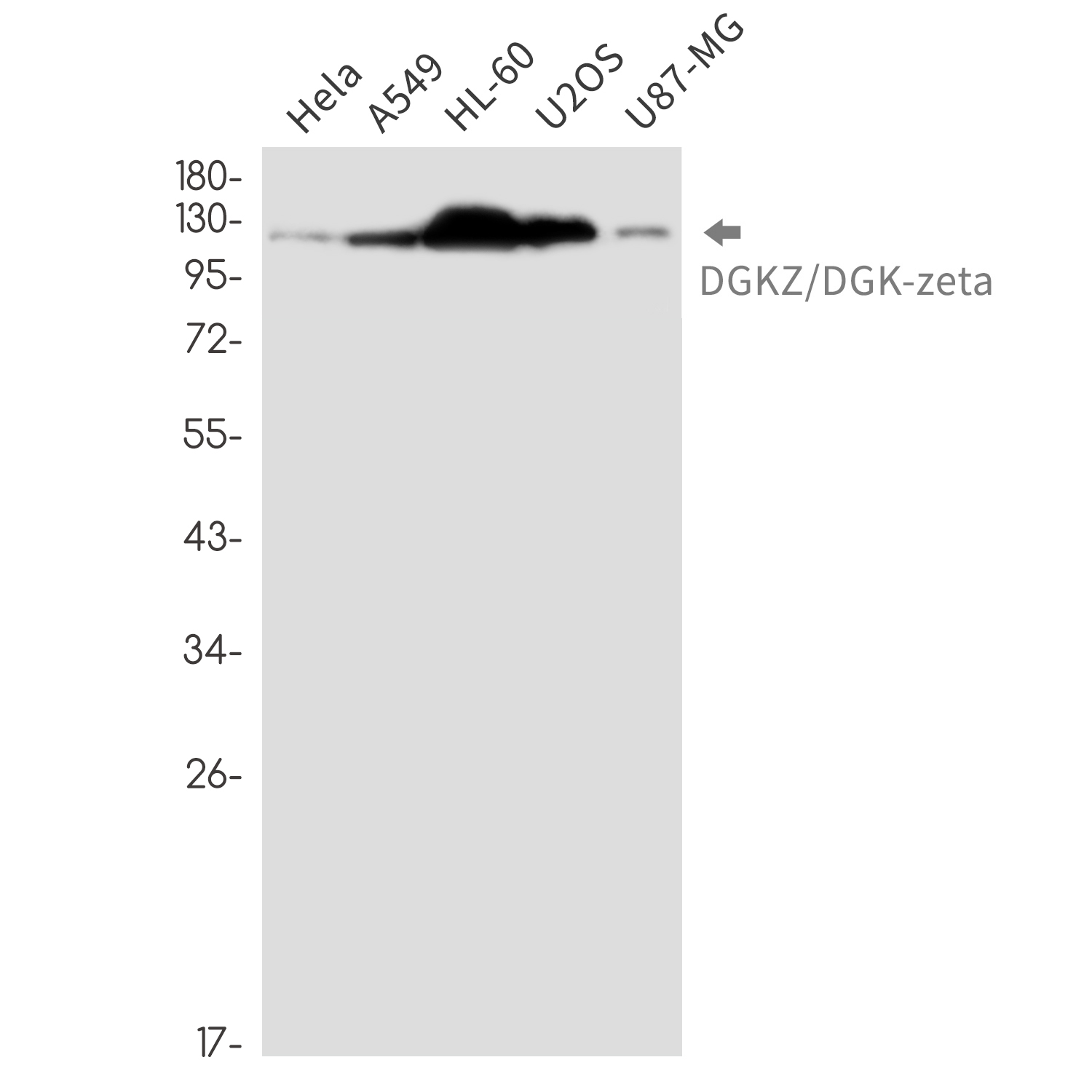 2 - DGKZ/DGK-zeta Rabbit mAb AP76469