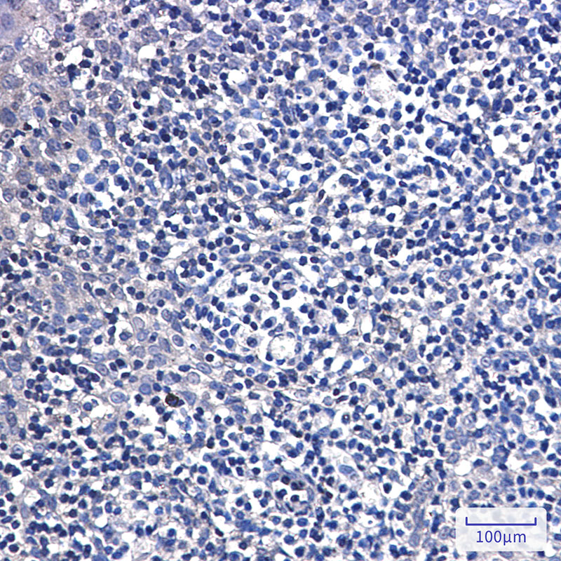 2 - DTYMK Rabbit mAb AP76473