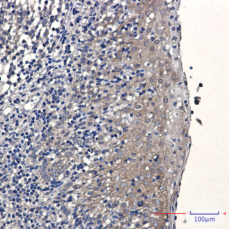 8 - eEF1A1/EF-Tu Rabbit mAb AP76475