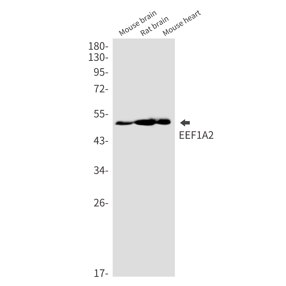 1 - EEF1A2 Rabbit mAb AP76476