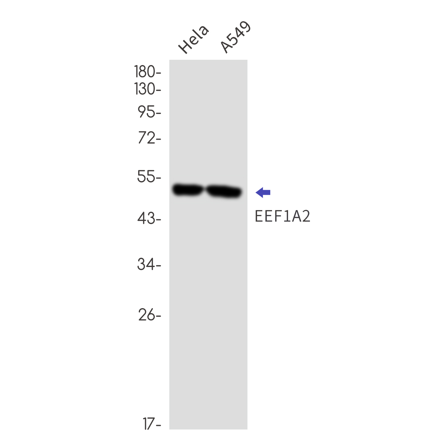 5 - EEF1A2 Rabbit mAb AP76476