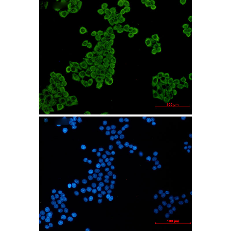 1 - EEF2/Elongation factor 2 Rabbit mAb AP76477