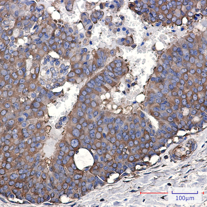 4 - EEF2/Elongation factor 2 Rabbit mAb AP76477