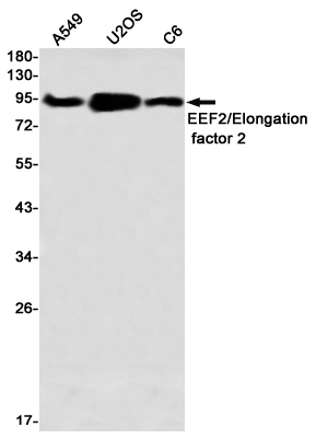 8 - EEF2/Elongation factor 2 Rabbit mAb AP76477