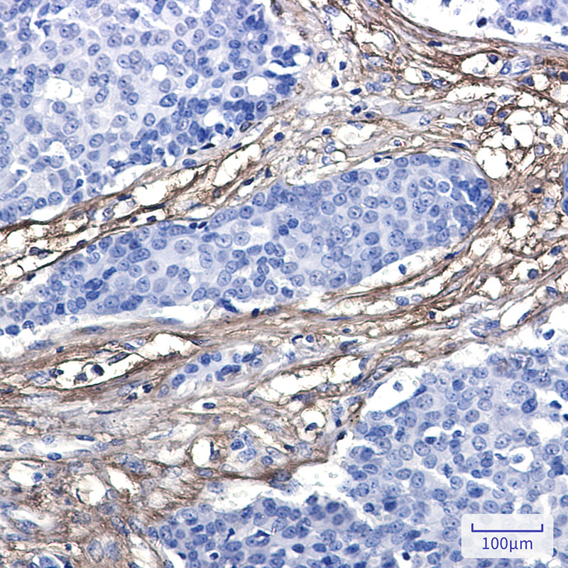 2 - [KO]EFEMP1 Rabbit mAb AP76478