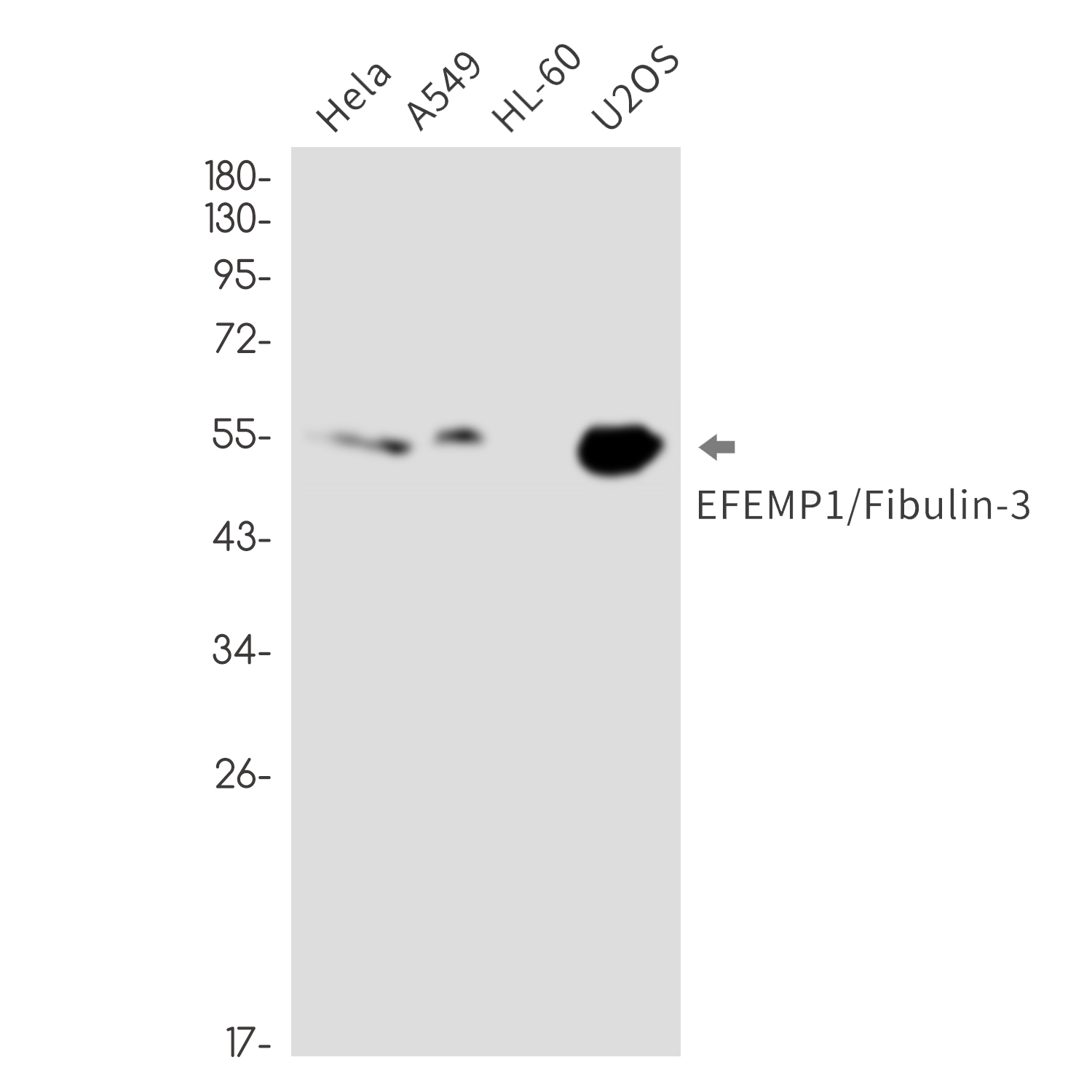 1 - [KO]EFEMP1 Rabbit mAb AP76478