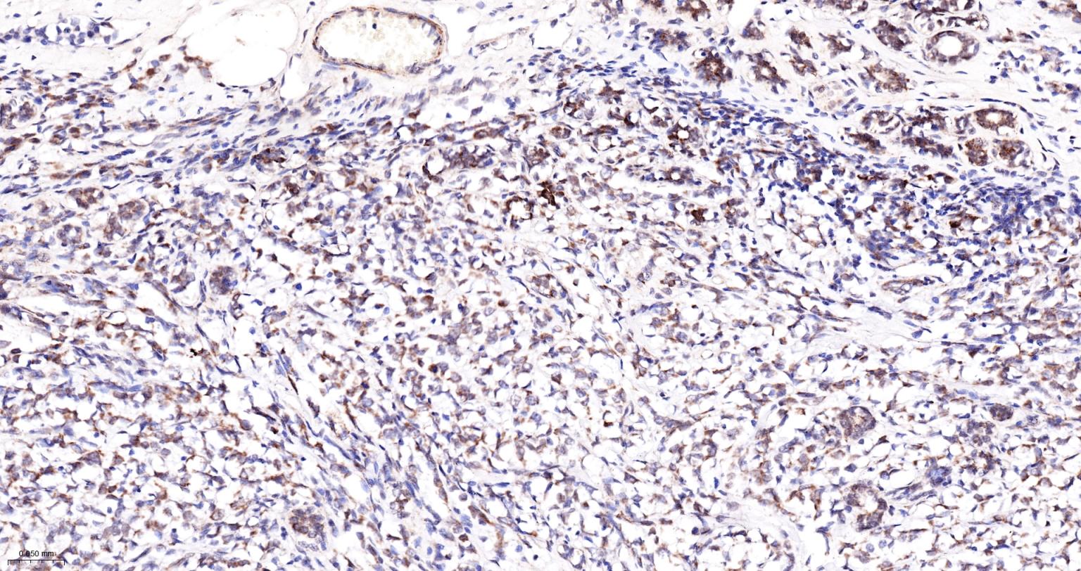 14 - PCCB Recombinant Mouse mAb AP94485