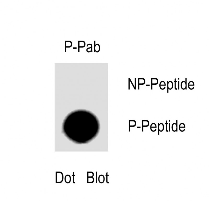 1 - Phospho-NPTX1-Y344 AP3930a