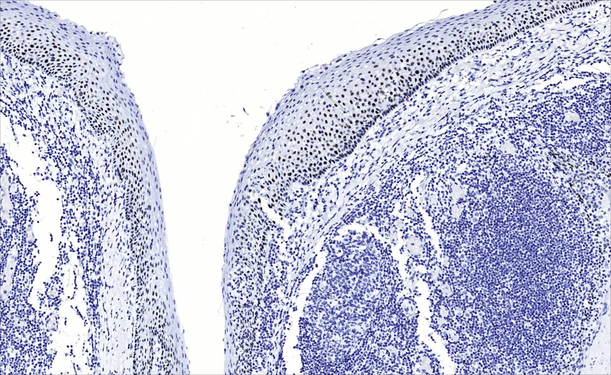 14 - p40 antibody AD80001