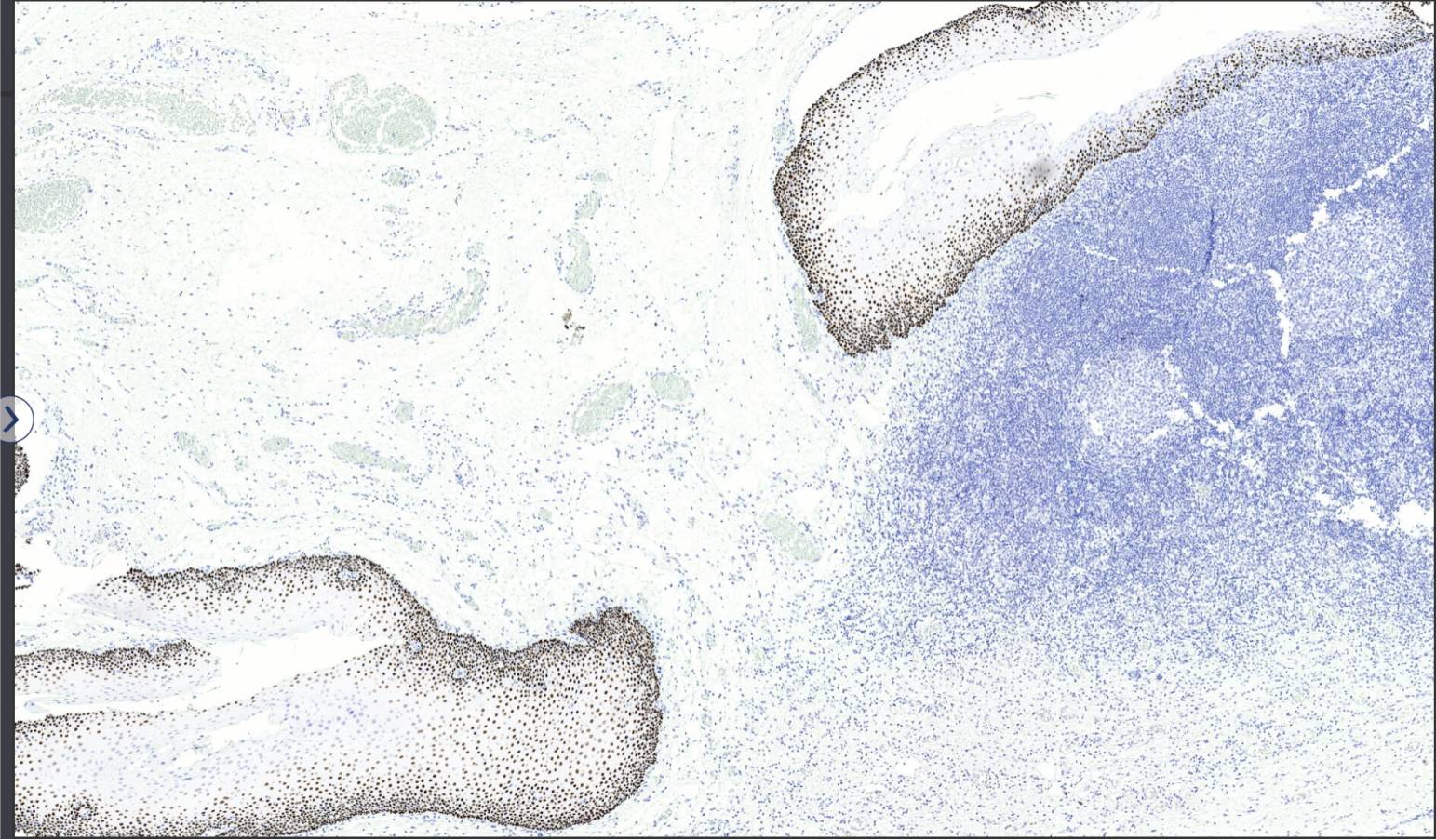 14 - p40 antibody AD80001
