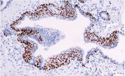 14 - p40 antibody AD80001