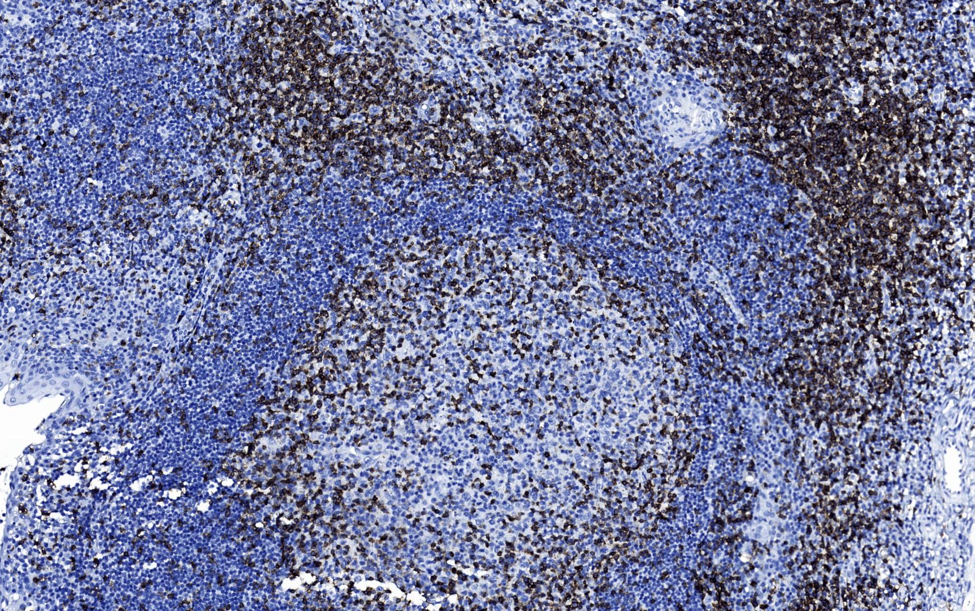 14 - Anti-CD3 antibody AD80004