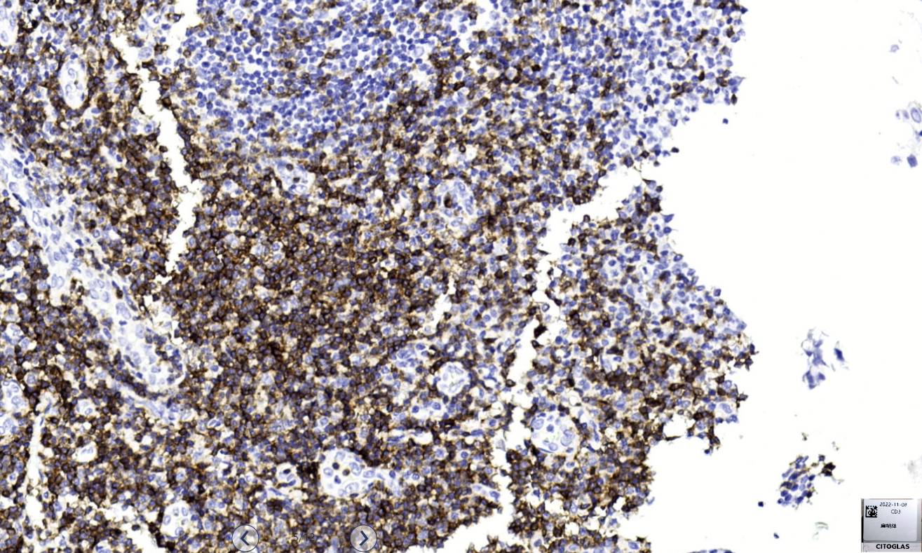 14 - Anti-CD3 antibody AD80004