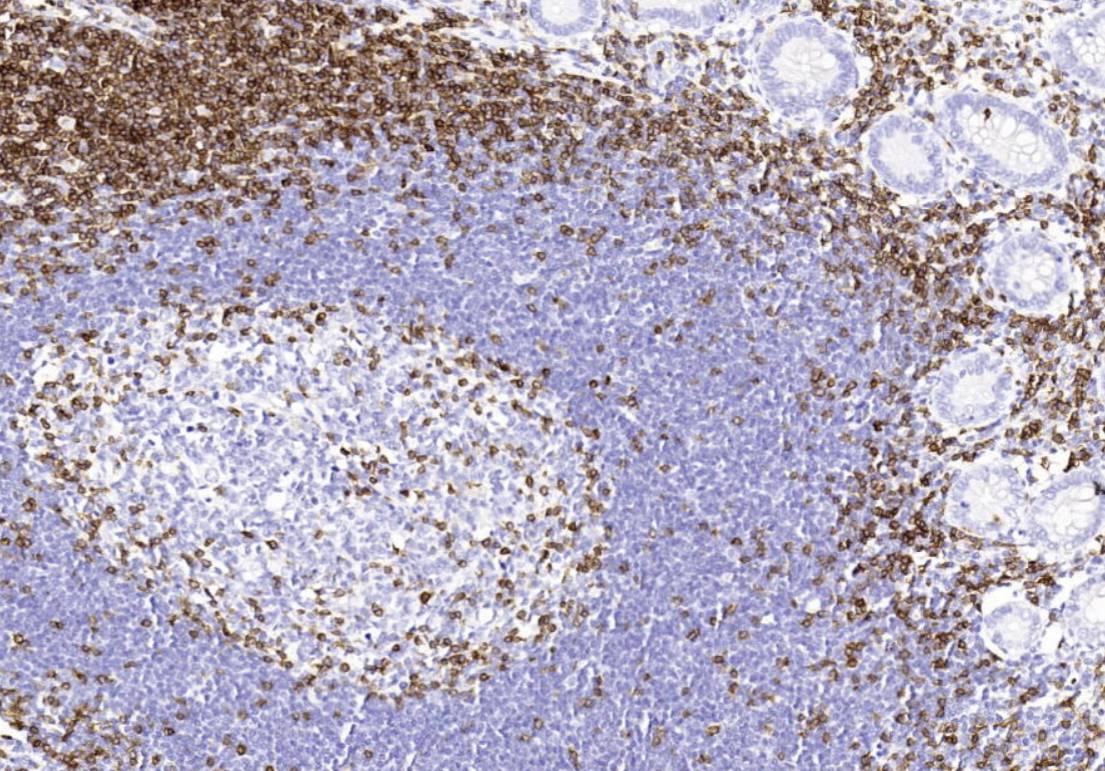 14 - Anti-CD3 antibody AD80004