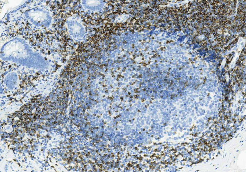 14 - Anti-CD3 antibody AD80004