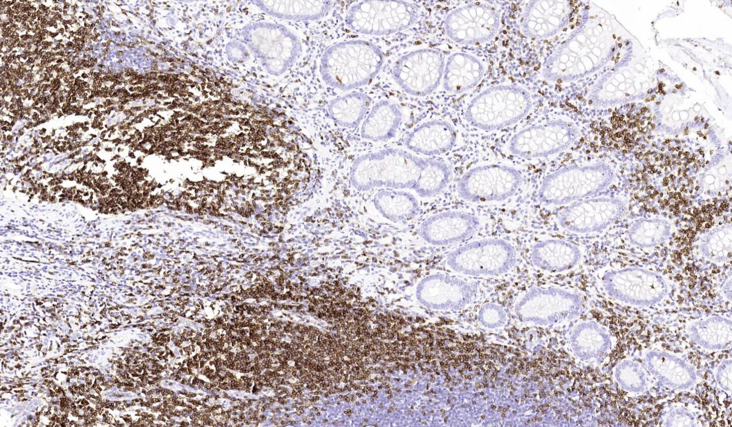 14 - Anti-CD3 antibody AD80004