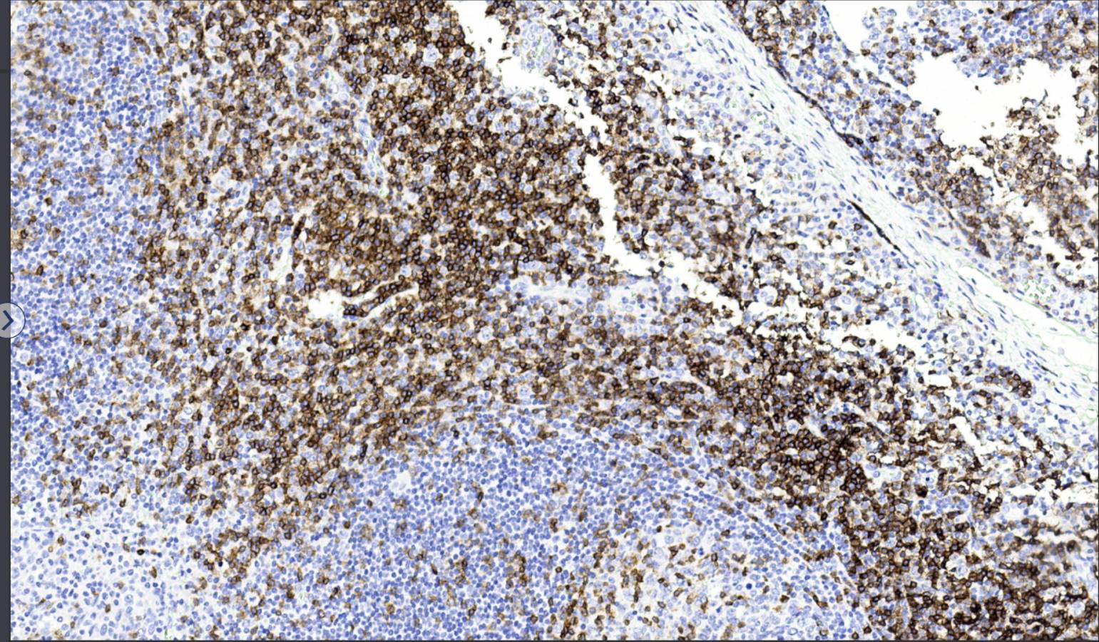 14 - Anti-CD3 antibody AD80004