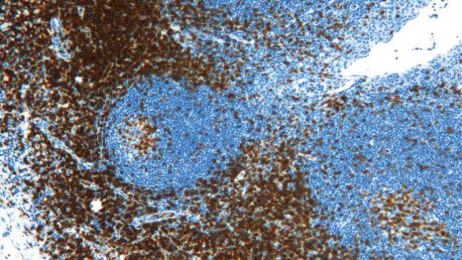 14 - Anti-CD3 antibody AD80004