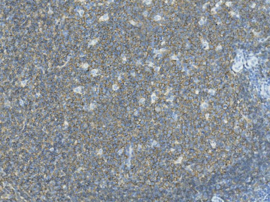 14 - CD19 AD80005