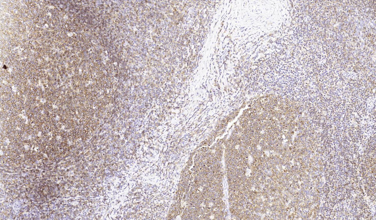 14 - CD19 AD80005